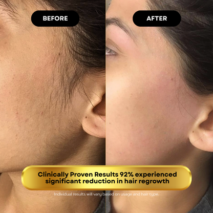 Cyperus Rotundus Hair Reduction Serum